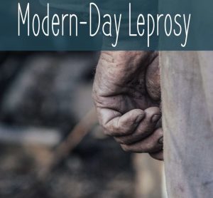 It’s World Leprosy day